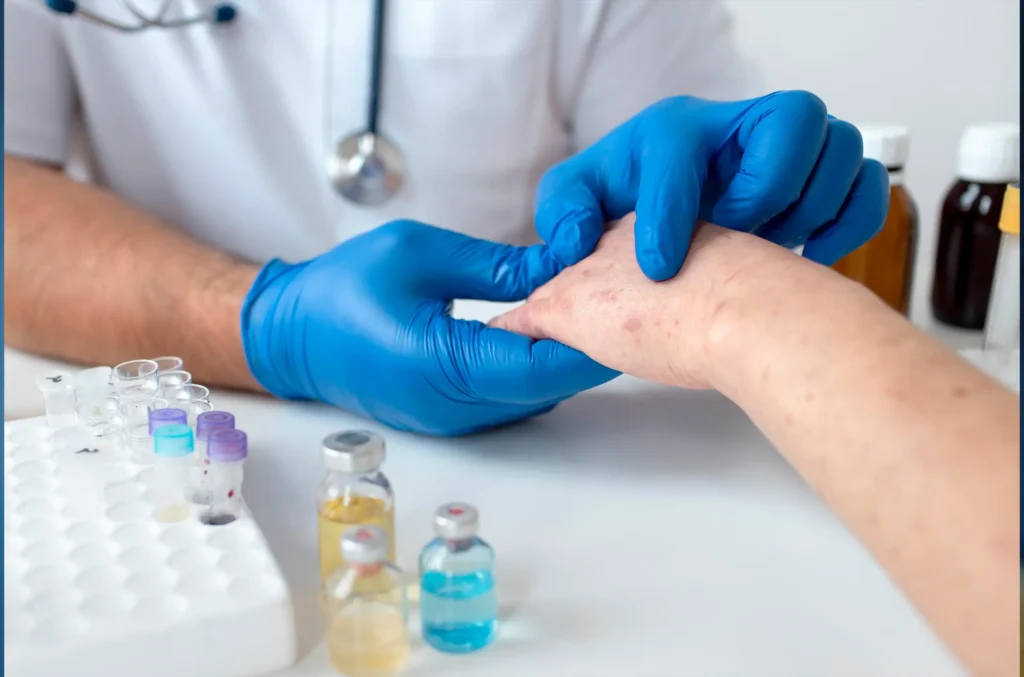 A physician examines a patient's hand as part of an allergy skin testing evaluation in a medical officeA physician inspects a child's hand as part of an allergy skin testing evaluation in a medical office.