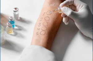 A healthcare professional performing a skin allergy test on a child's arm, using a small needle and allergy testing materials.