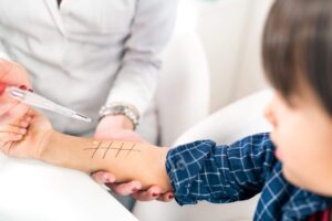 A child is being given an allergy skin test an by a doctor