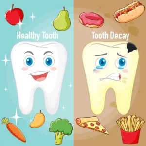 The image compares a healthy tooth to a decayed tooth, highlighting the impact of different types of food on dental health.