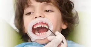 The image shows a child receiving fluoride treatment at the dental clinic, where the dentist applies fluoride to the teeth. This procedure is common and used to protect the teeth from cavities and enhance oral health. 