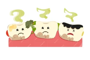 Illustration of three cartoon teeth affected by poor oral hygiene, showing signs of decay and plaque. One tooth has visible food stuck, another is discolored, and the last tooth is severely decayed with a sad expression, emitting a bad odor. 