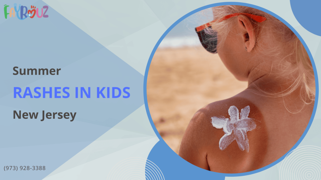 When to Worry about Summer Rashes in Kids in Clifton, NJ?